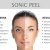 BBS Care Sonic Peel Ultraschallpeelinggerät Mikrodermabrasion Ionentherapie -Ultraschall Skin Scrubber Gesichts - 3